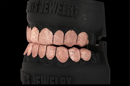 Diamond Dust Grillz