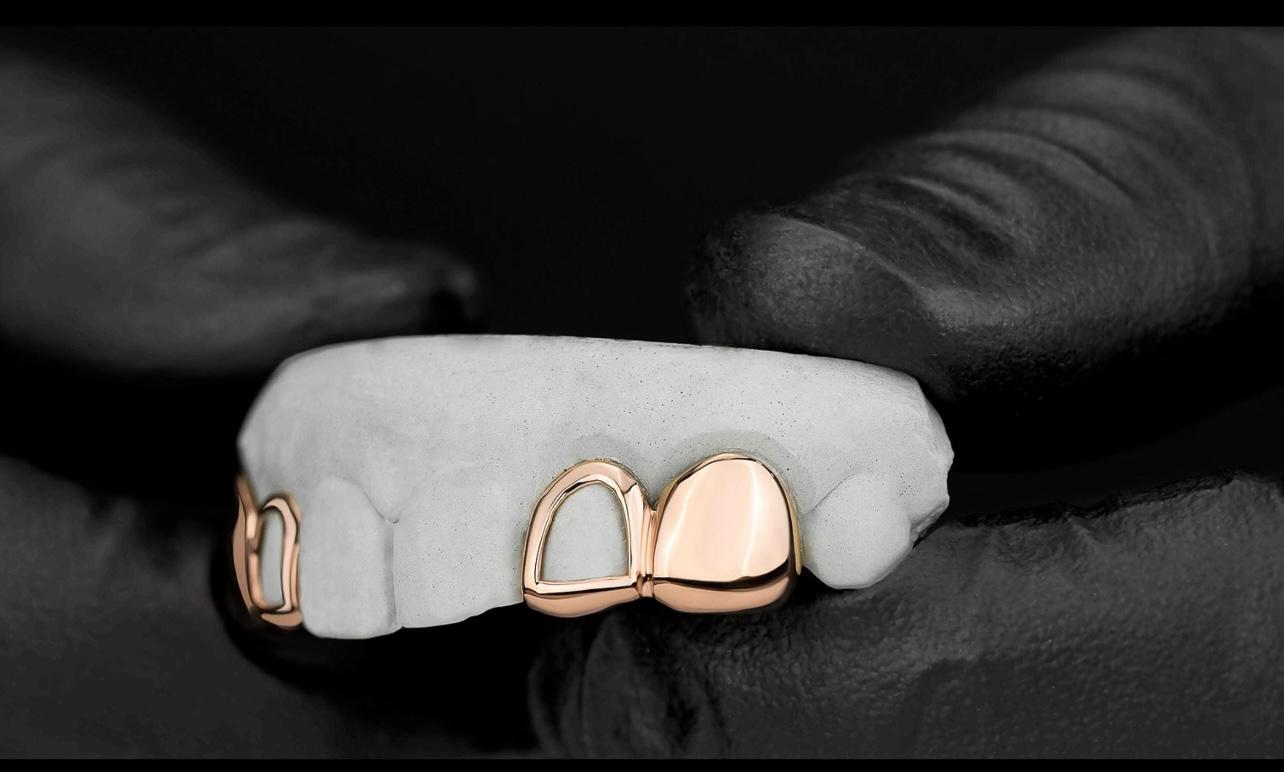 Open Face And Solid Grillz