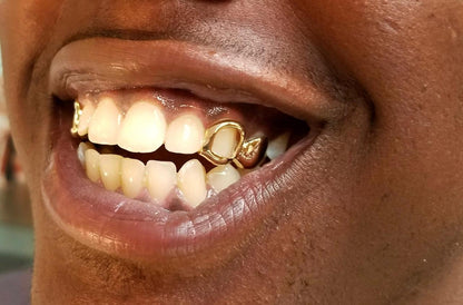 Open Face And Solid Grillz