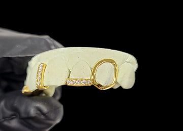 Gap Filler With The Diamond Open Face