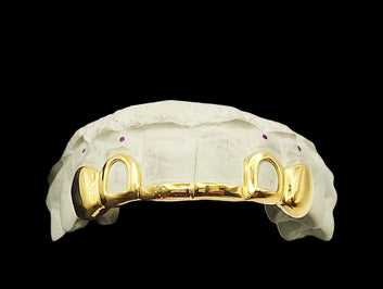 6-Piece Custom Grillz – Solid Front Tips, Open Face & Solid Canines